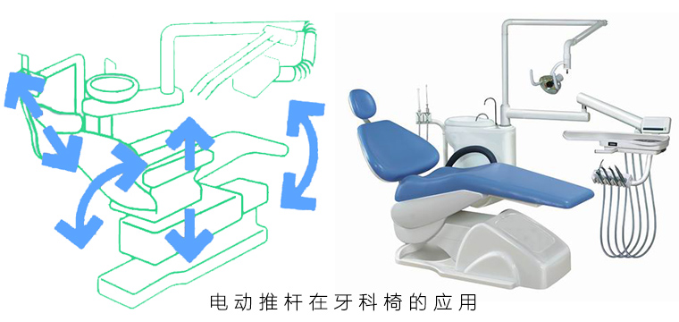 電動推桿在牙科椅上的應用